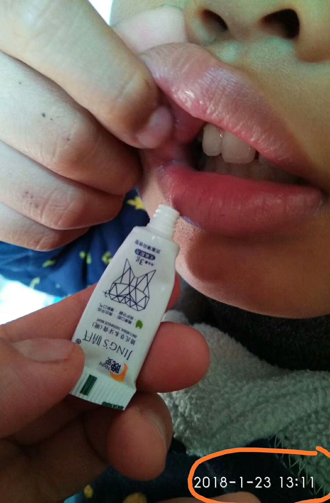 婧氏草本牙膏 解決你的口腔问题 效果100% 無效退款