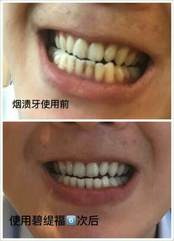 碧缇福美牙仪代理