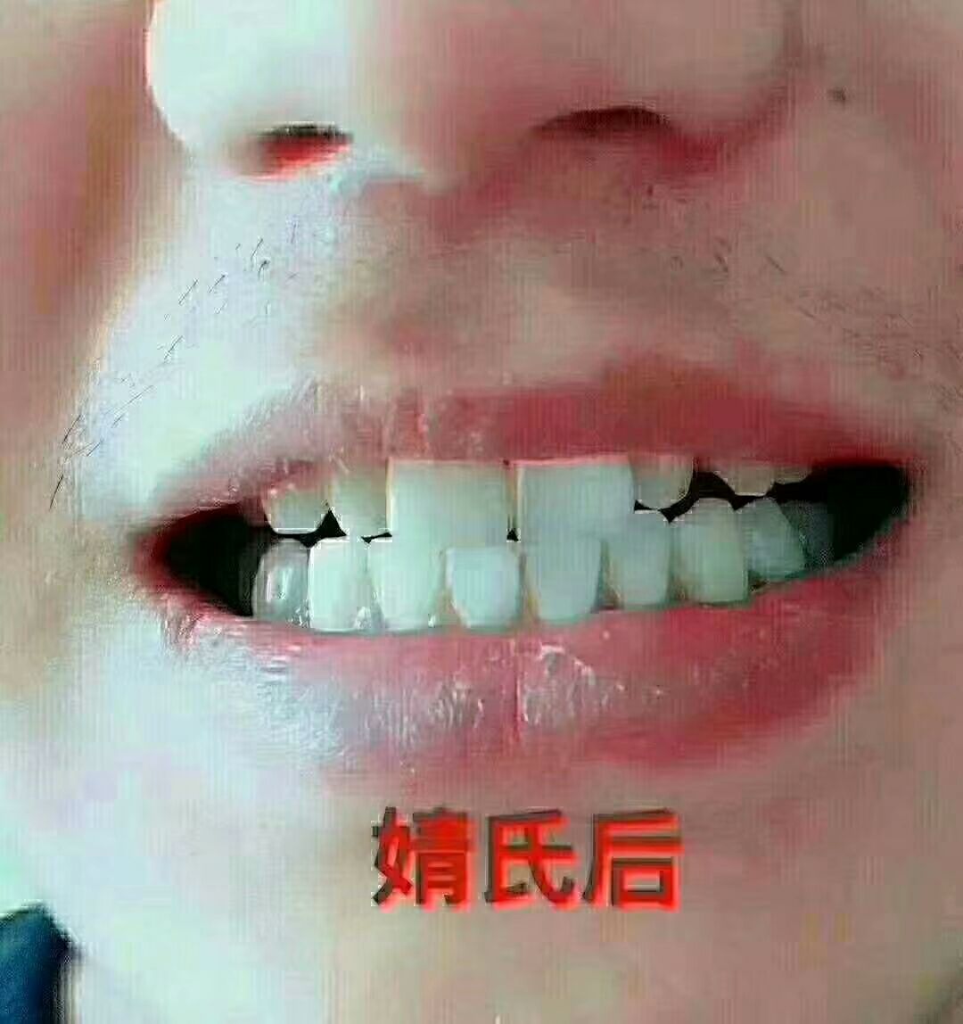 婧氏草本无氟牙膏 专业修护口腔问题