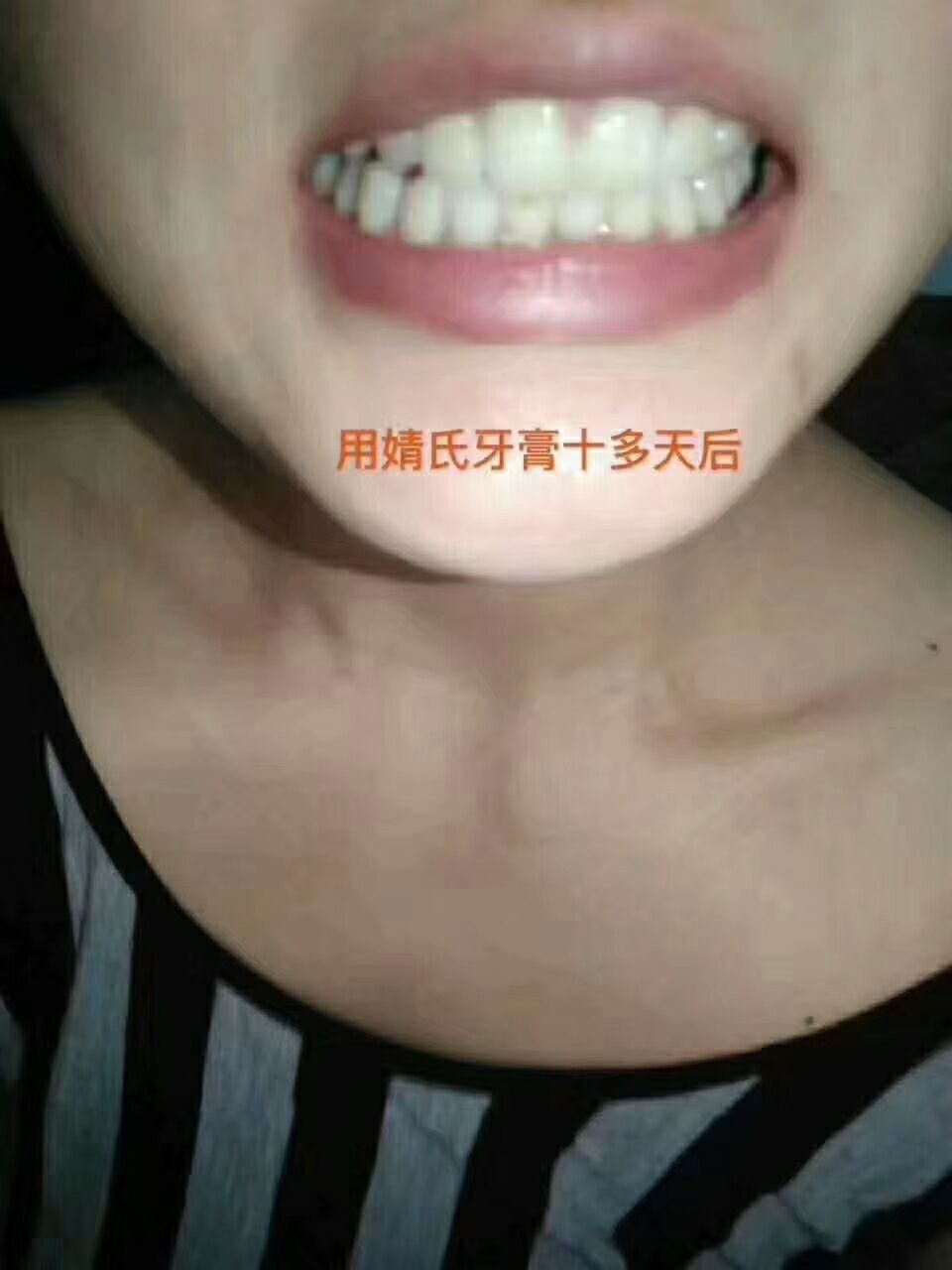 婧氏牙膏修复各种口腔问题