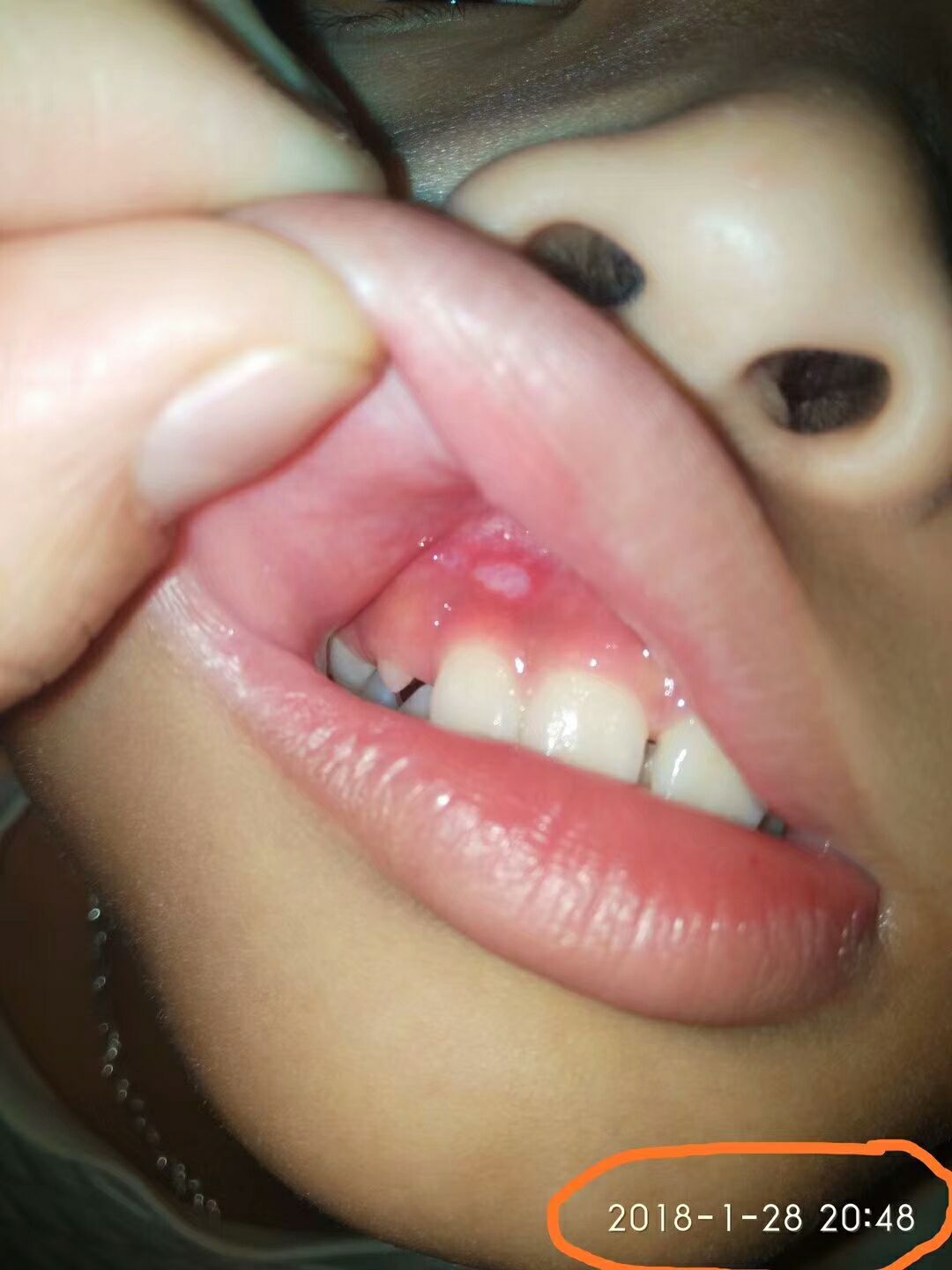 婧氏草本牙膏 解決你的口腔问题 效果100% 無效退款