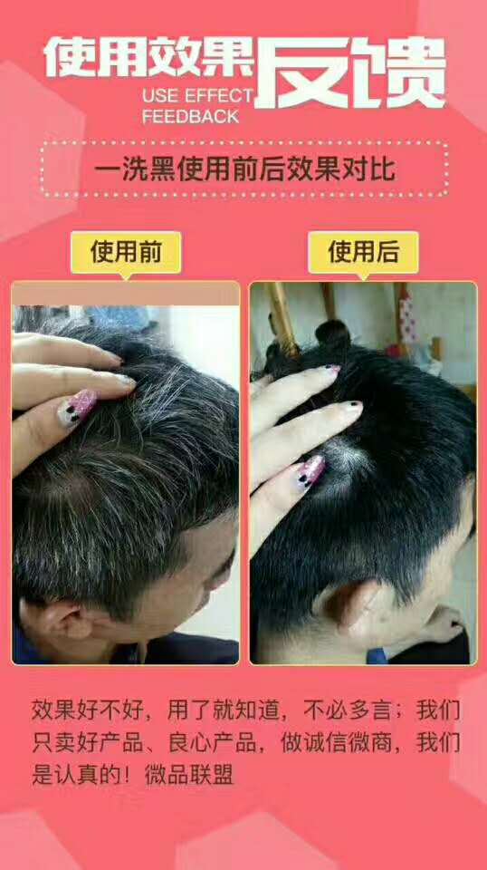 木兰朵鲜花一洗黑怎么代理？有价格表吗？
