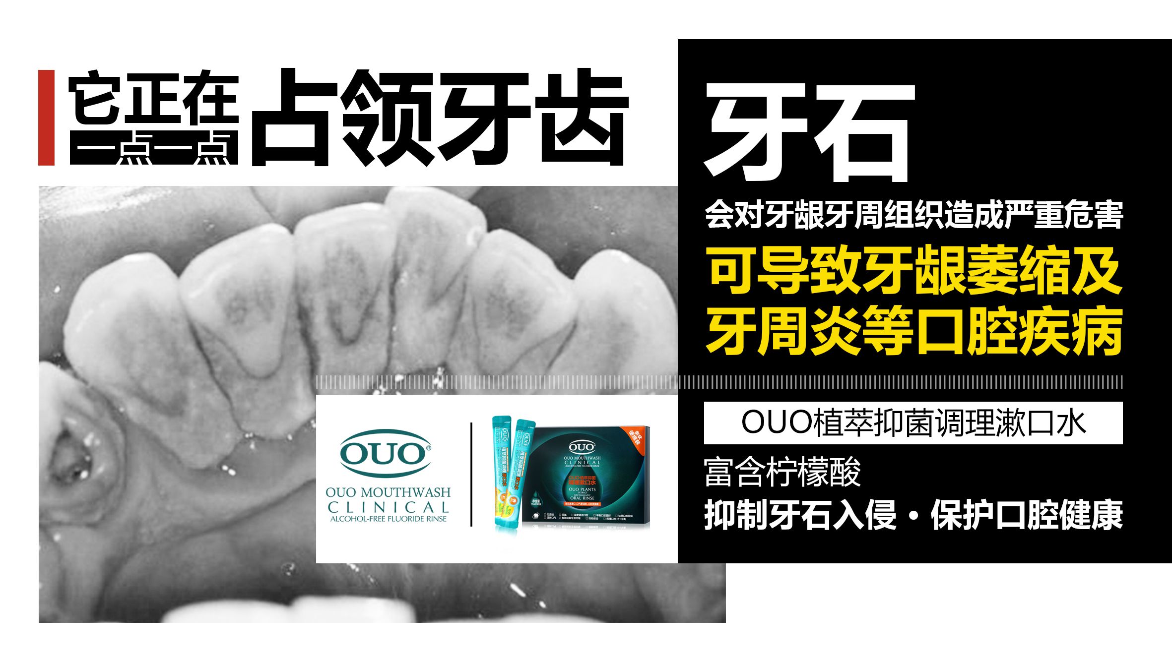 的新型漱口水产品 ouo漱口水 携带方便 清新脱俗