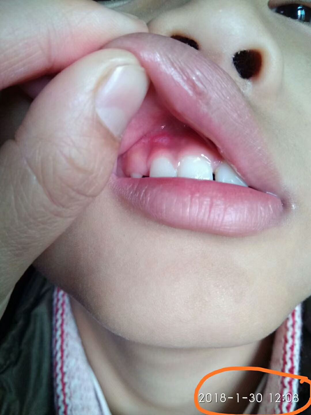 婧氏草本牙膏 解決你的口腔问题 效果100% 無效退款