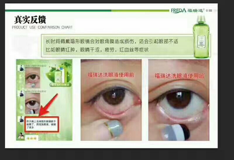 福瑞达医疗企业洗眼液