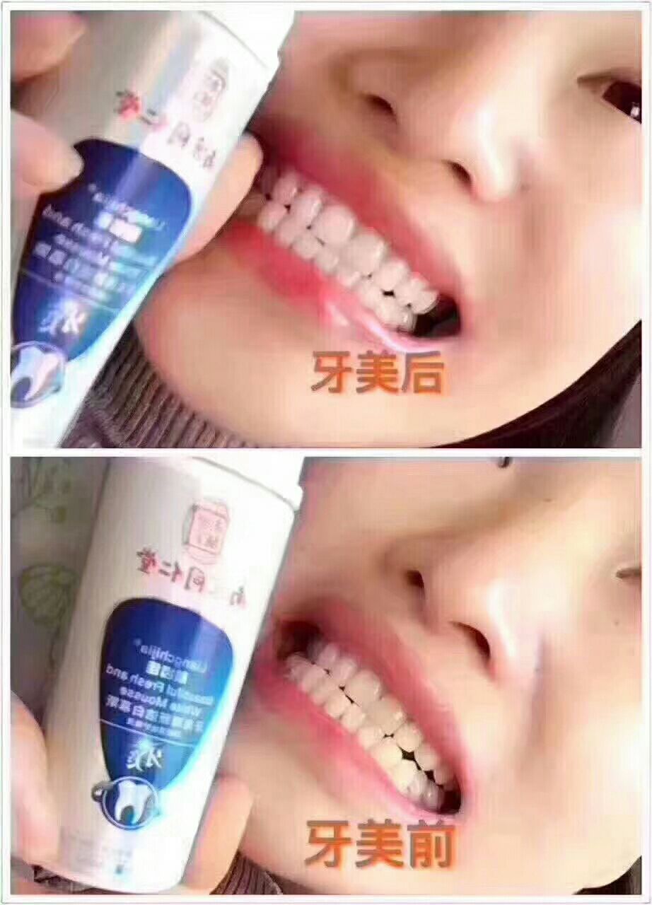 美白洁齿慕斯牙美