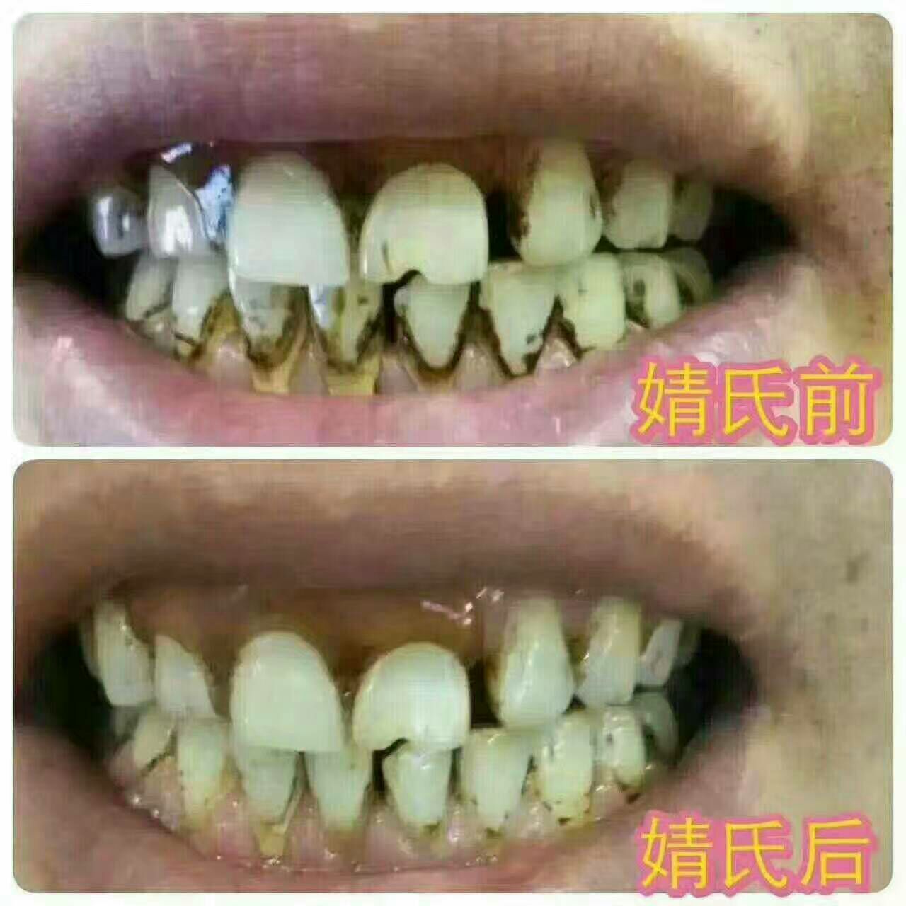 你有口腔困扰吗？