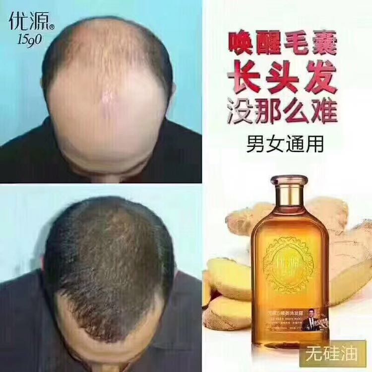 优源洗护500拿货当代理。长线品牌