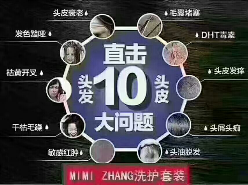 张咪代言的，咪咪张招代理火热进行中