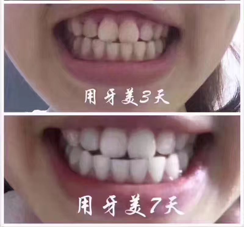 南京同仁堂牙美 代理199不拿货  拿货5支直接做代理