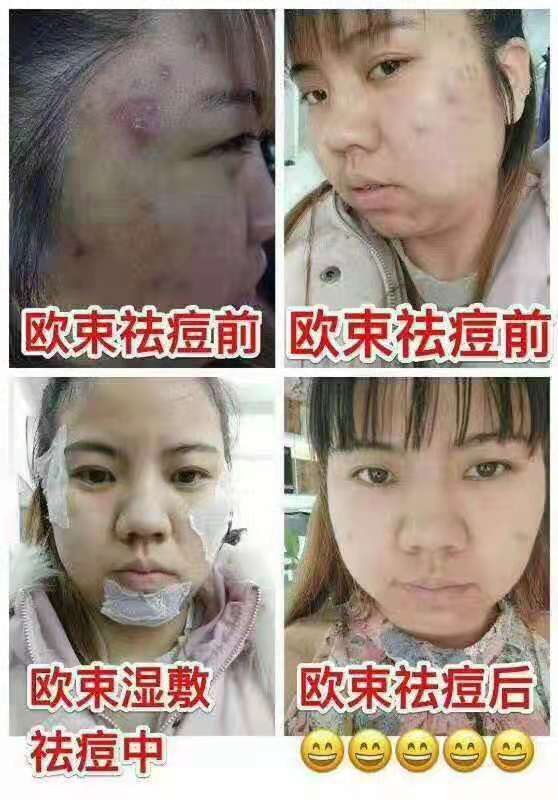 欧束，你值得拥有❗❗