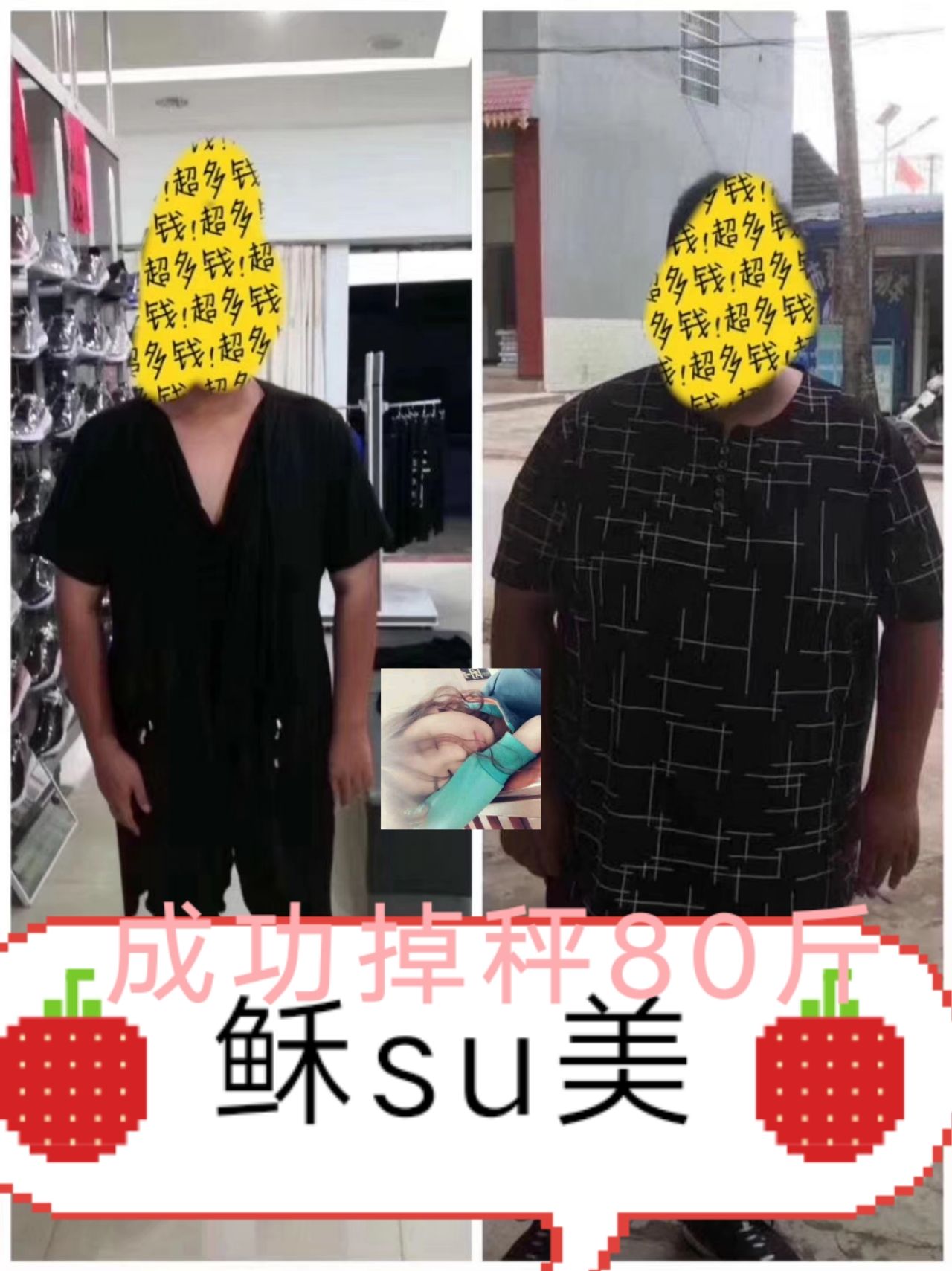 稣su美品牌中药外敷减肥产品，