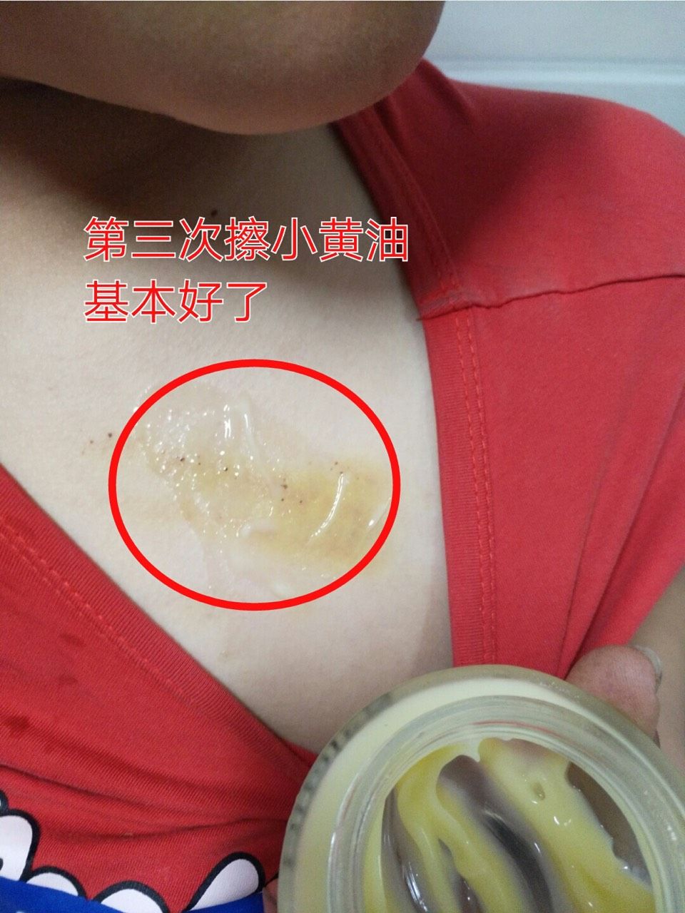 娜兰蒂姿护肤品 满600做代理