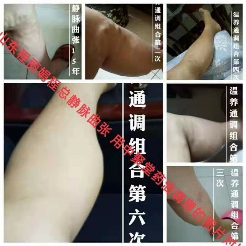 【镇络油】中聚堂健康养生