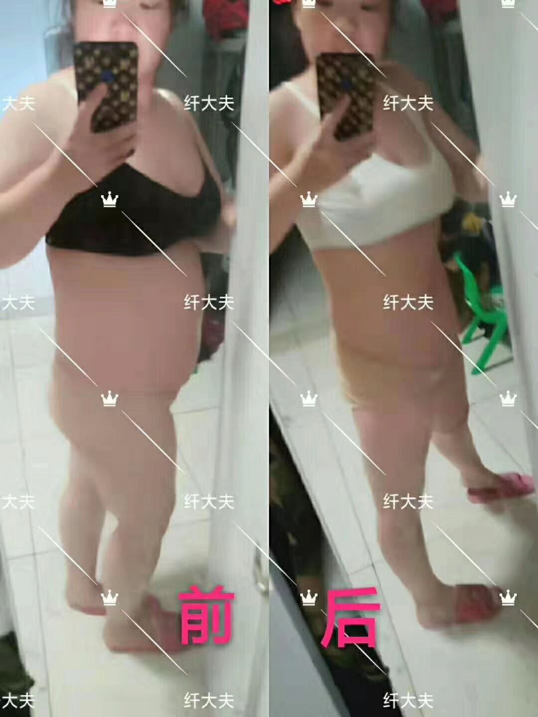 我是一粒轻中药减肥瘦身代理需要减肥，瘦身的宝宝可以加我