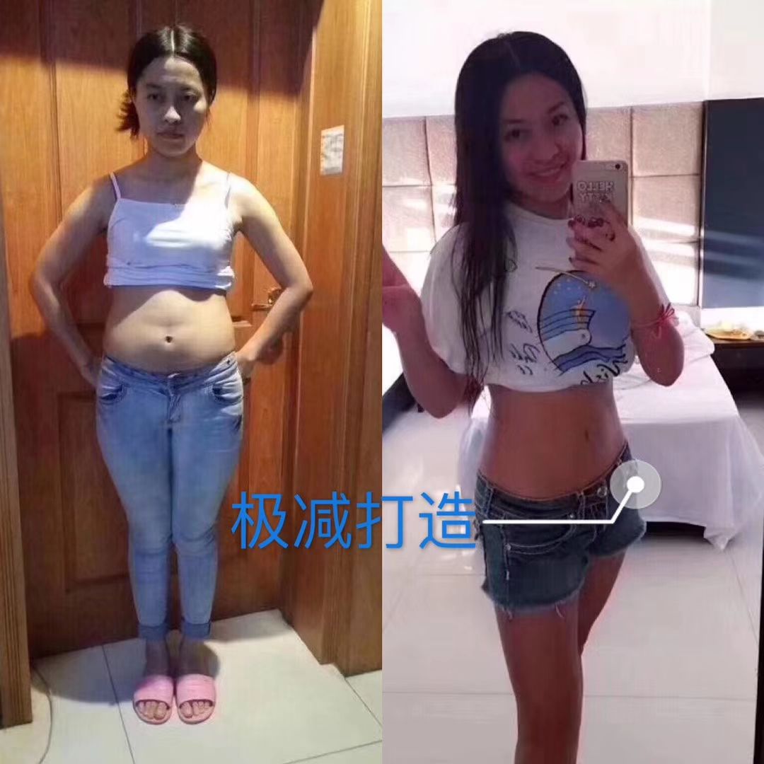 网红代言瘦身产品 极减益生菌招代理