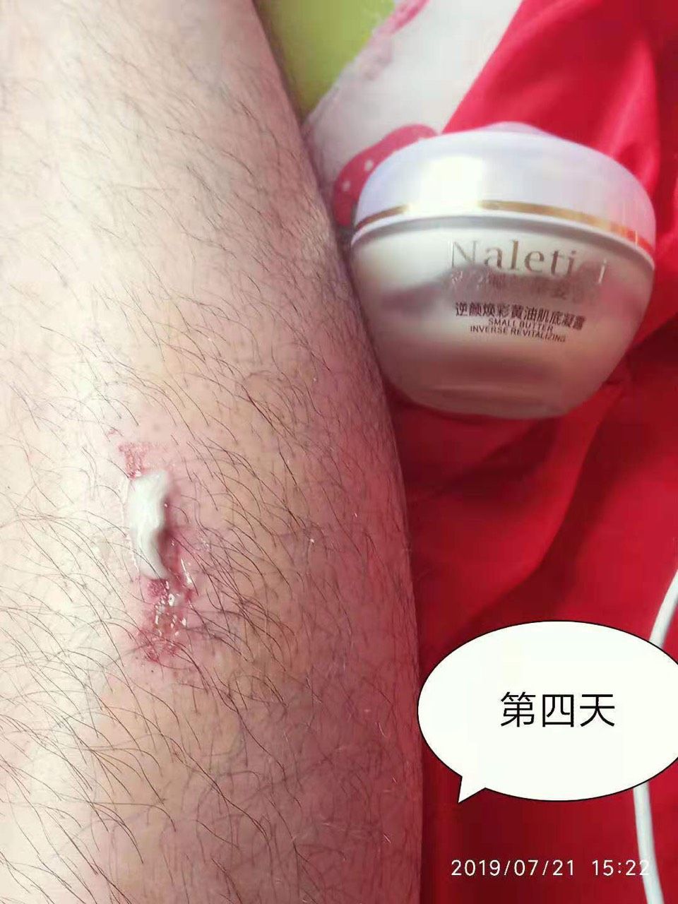 娜兰蒂姿护肤品 满600做代理