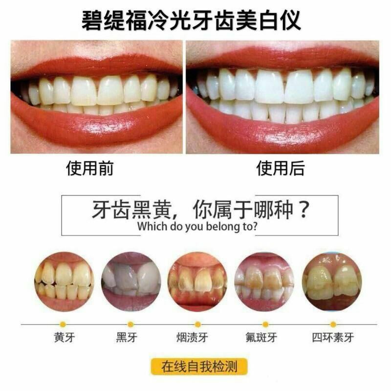 美牙仪能让你10-15天从内到外置换出牙齿附着色素也就变白了