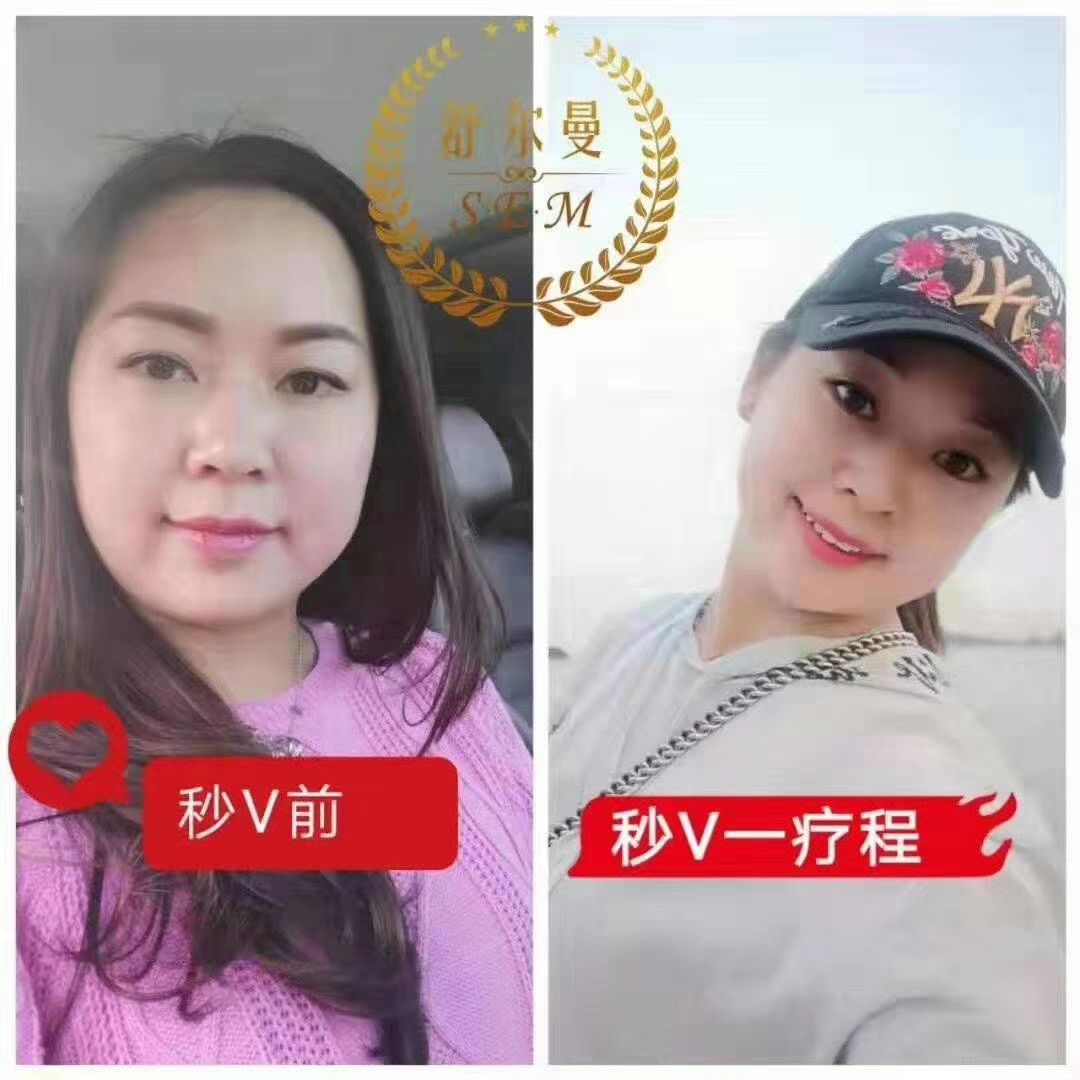舒尔曼秒V•单侧体验一次效果耳穴疗法：瑞士能量石含有72种