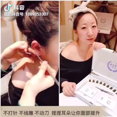 舒尔曼秒V•单侧体验一次效果耳穴疗法：瑞士能量石含有72种