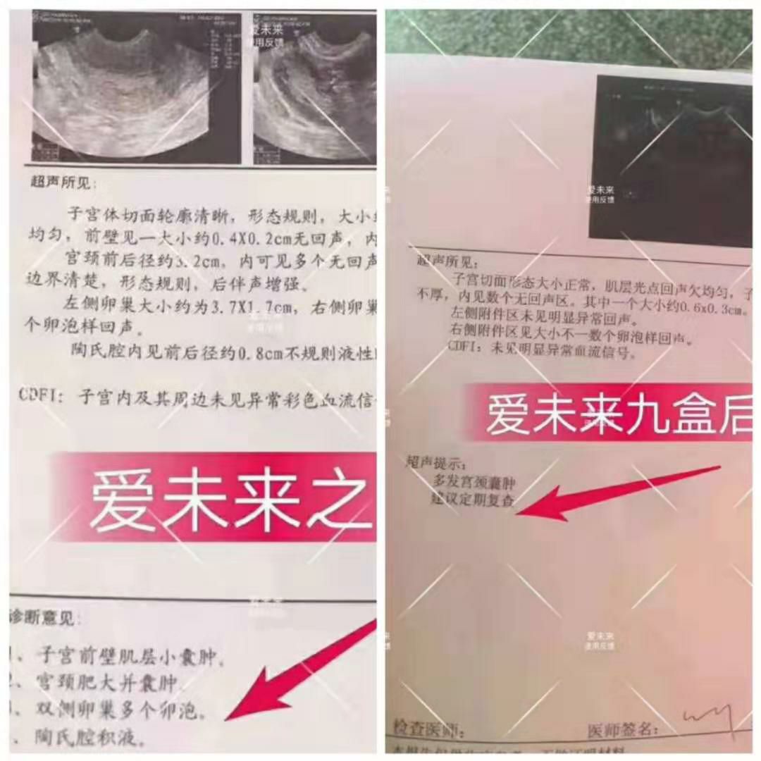爱未来一类械字号私护产品