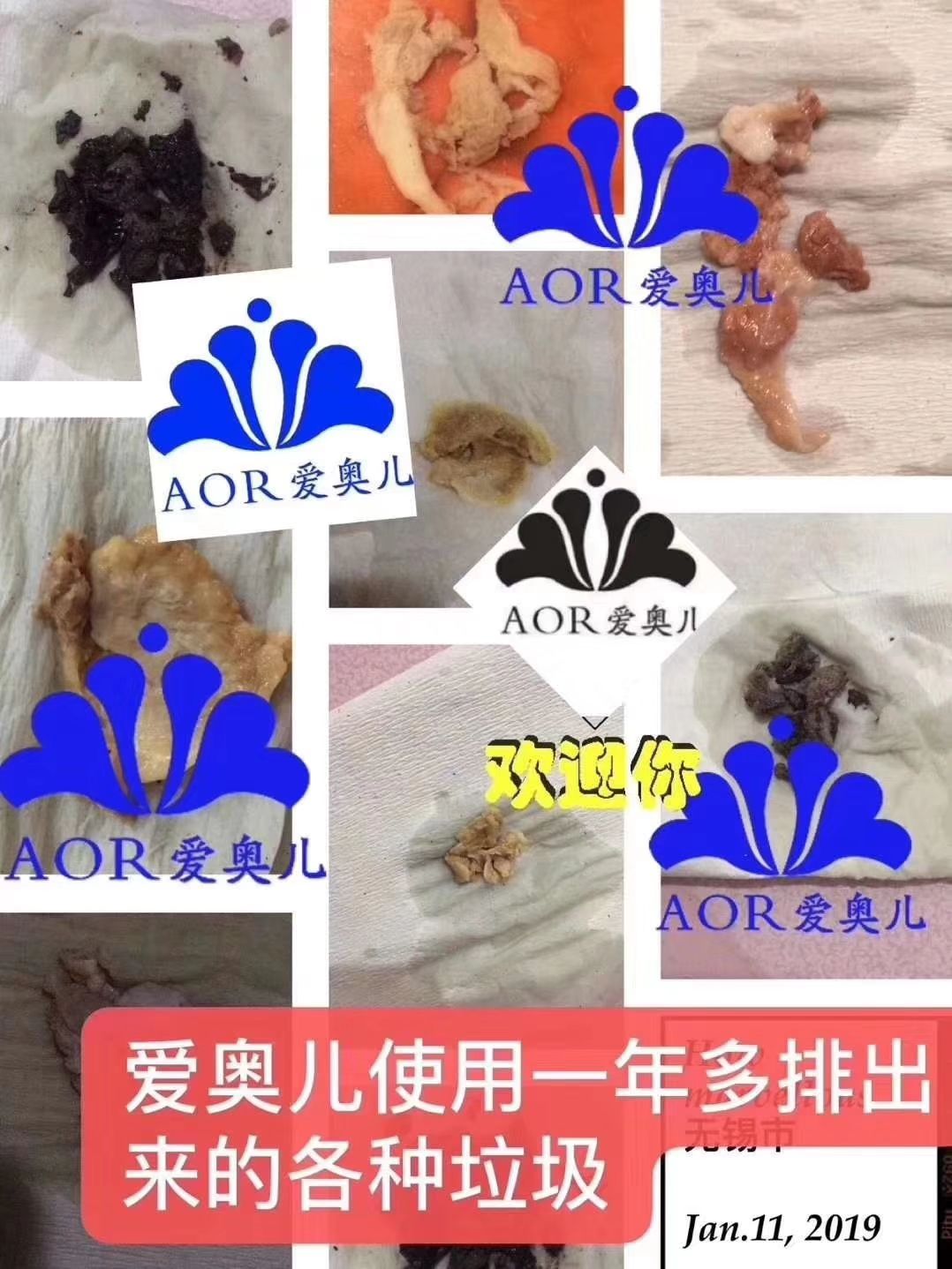 美拉女王+AOR