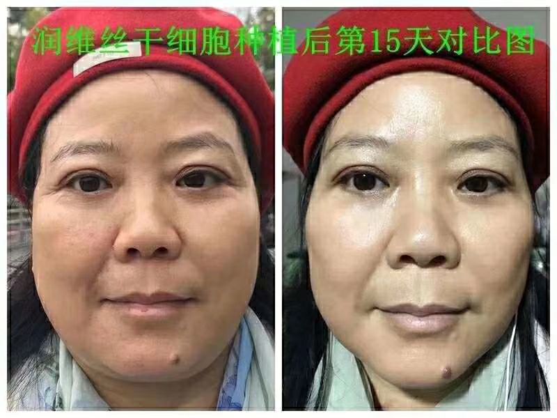 广东肽诺干细胞