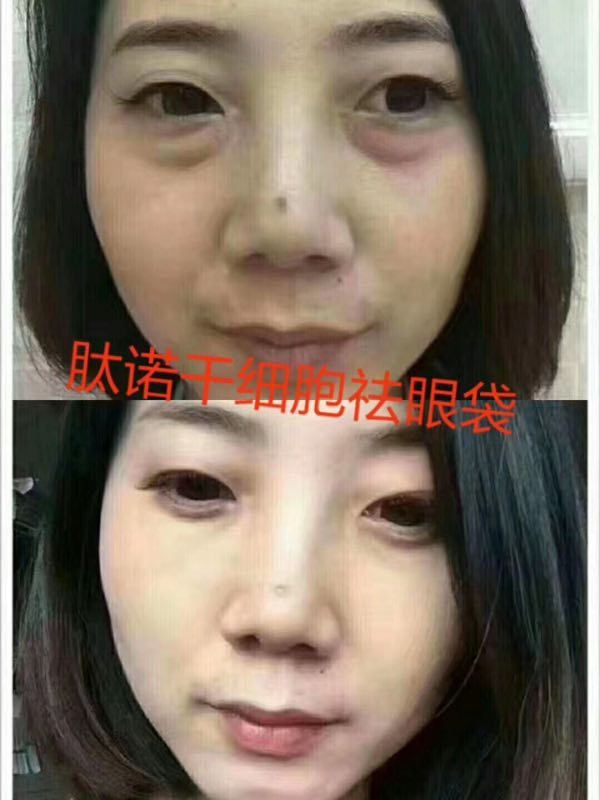 广东肽诺干细胞