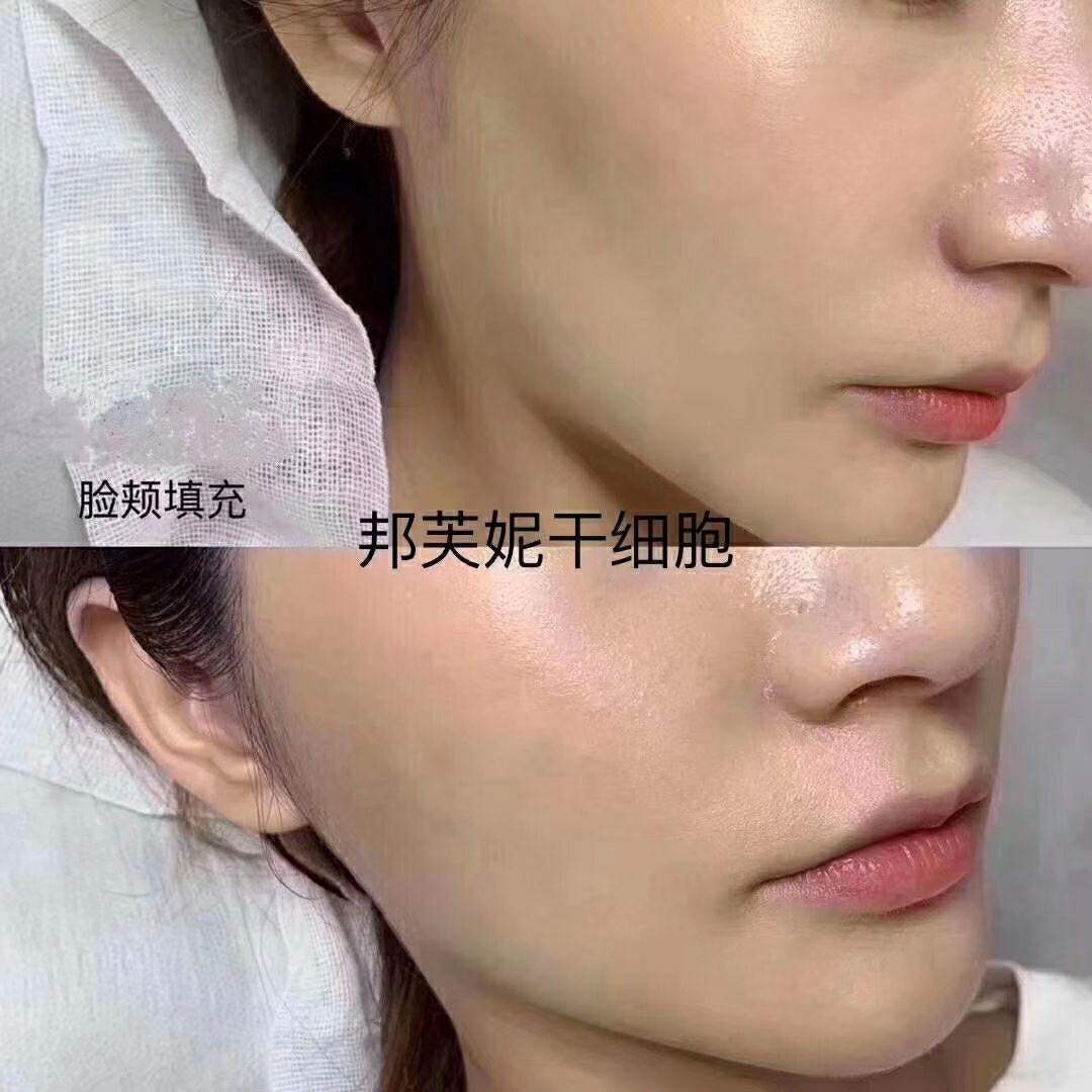 广东肽诺干细胞