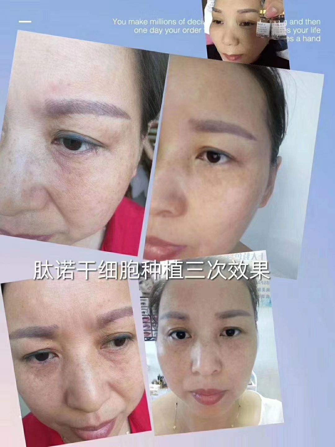 广东肽诺干细胞