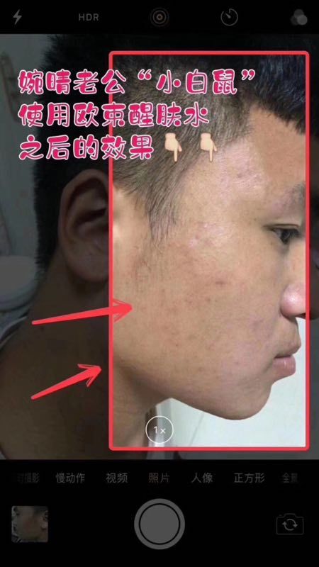 欧束醒肤水，保湿补水，吸收很快，可以祛痘的