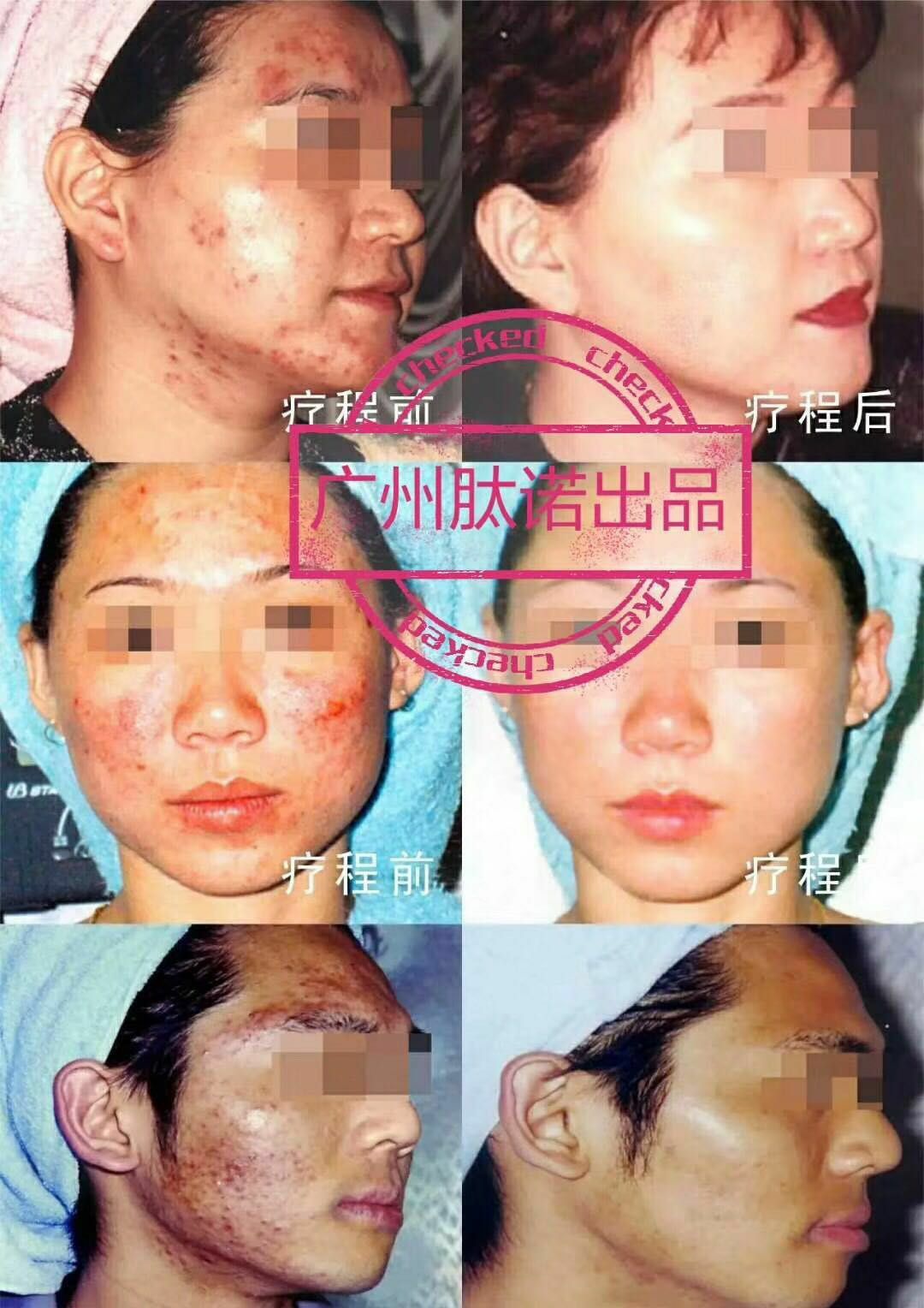广东肽诺干细胞