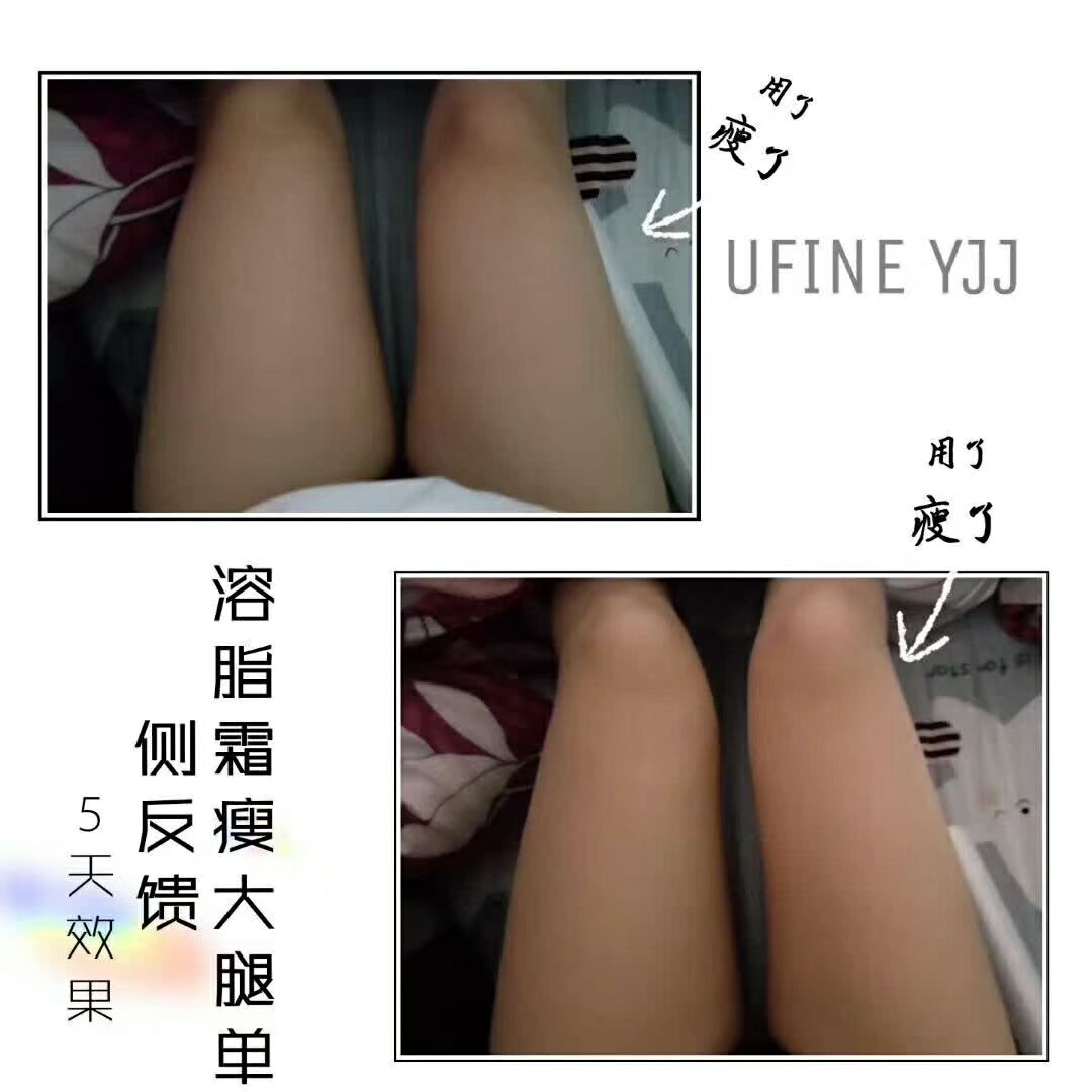 网红溶脂霜（招代理）