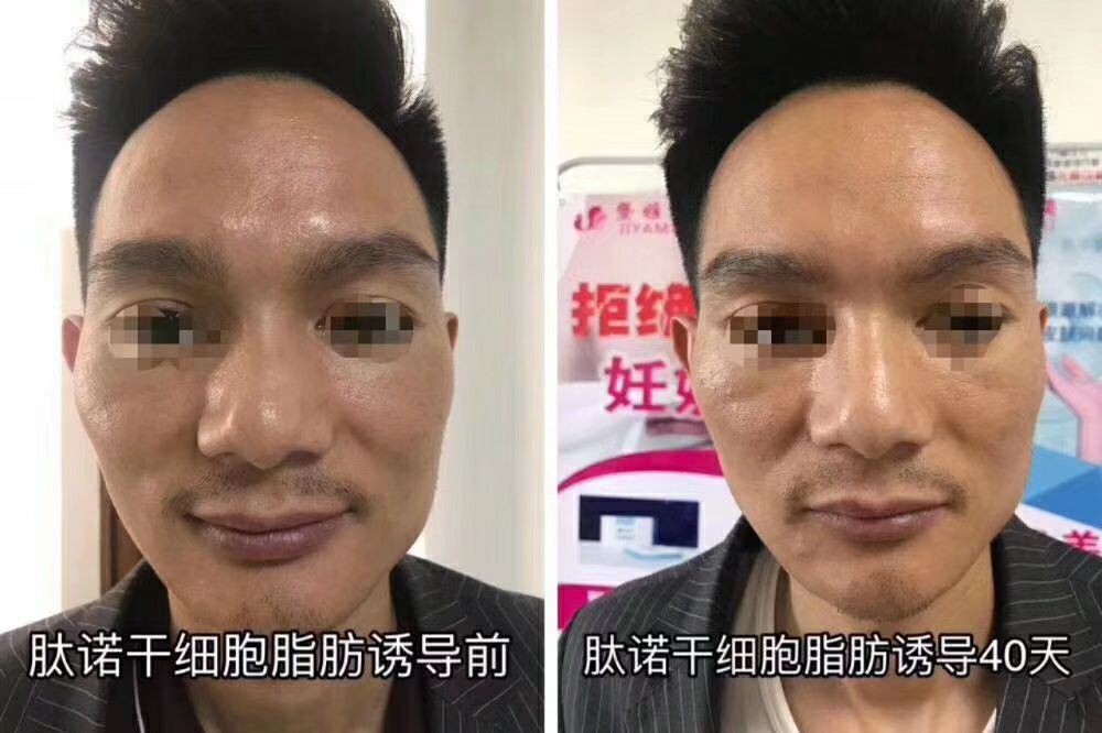 广东肽诺干细胞