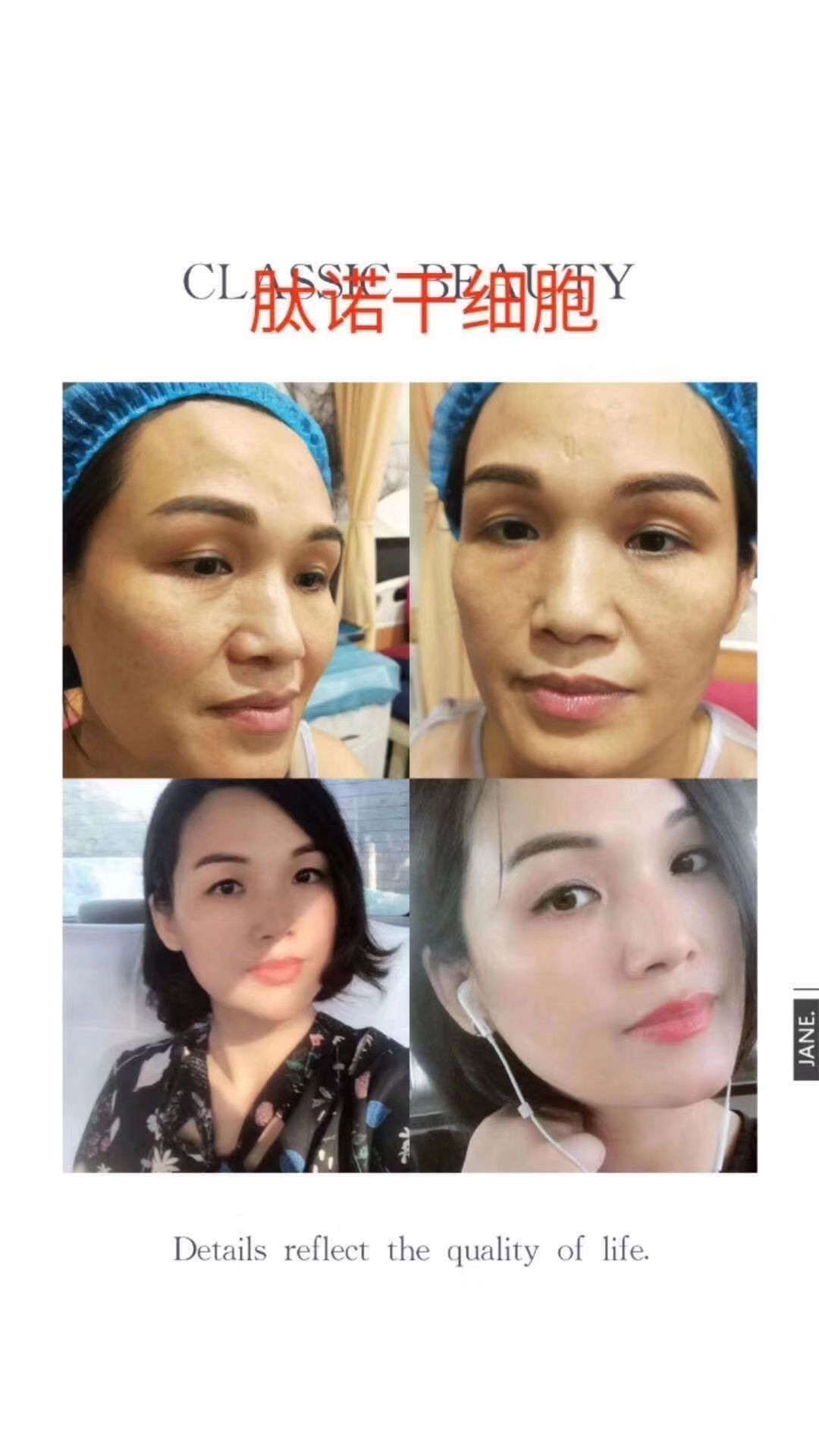广东肽诺干细胞