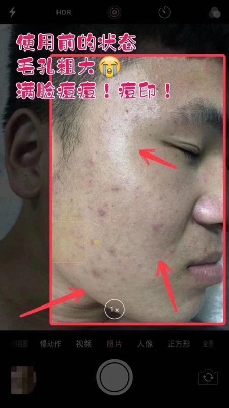 欧束醒肤水，保湿补水，吸收很快，可以祛痘的
