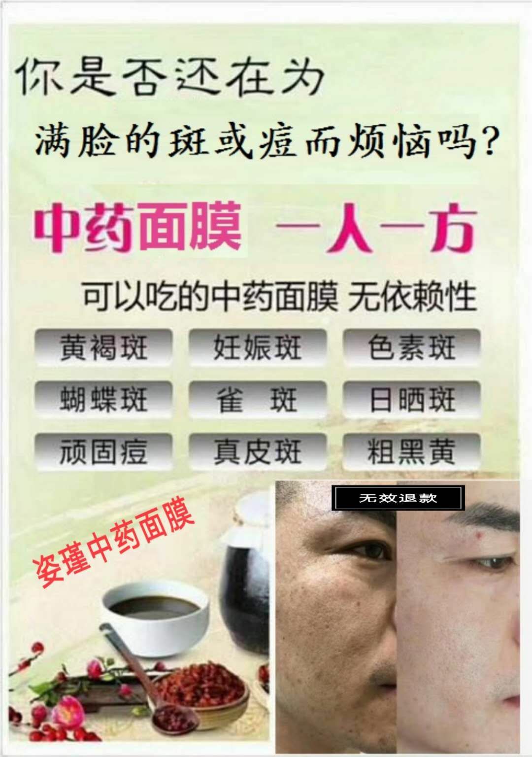 中药面膜 无需囤货  没用上家  无效退款