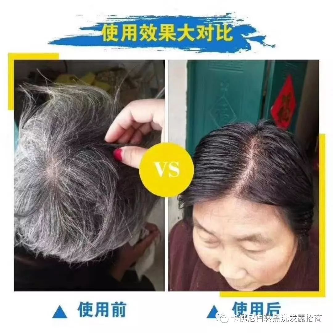 卡佛尼白转黑洗发露，十分钟洗发上色不伤发，效果立竿见影！