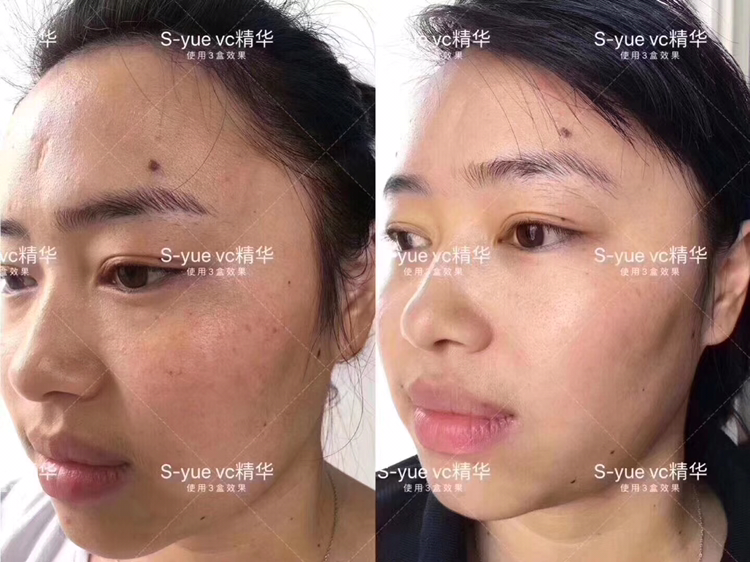 奢悦美白淡斑三件套 搭配效果惊人