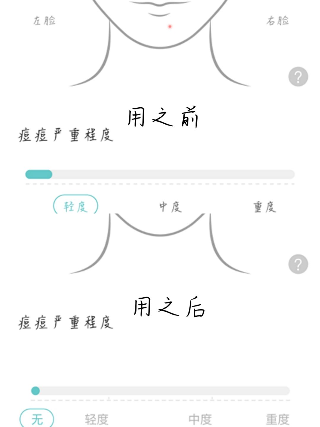 招代理，美白祛痘减肥，无效来找我退款