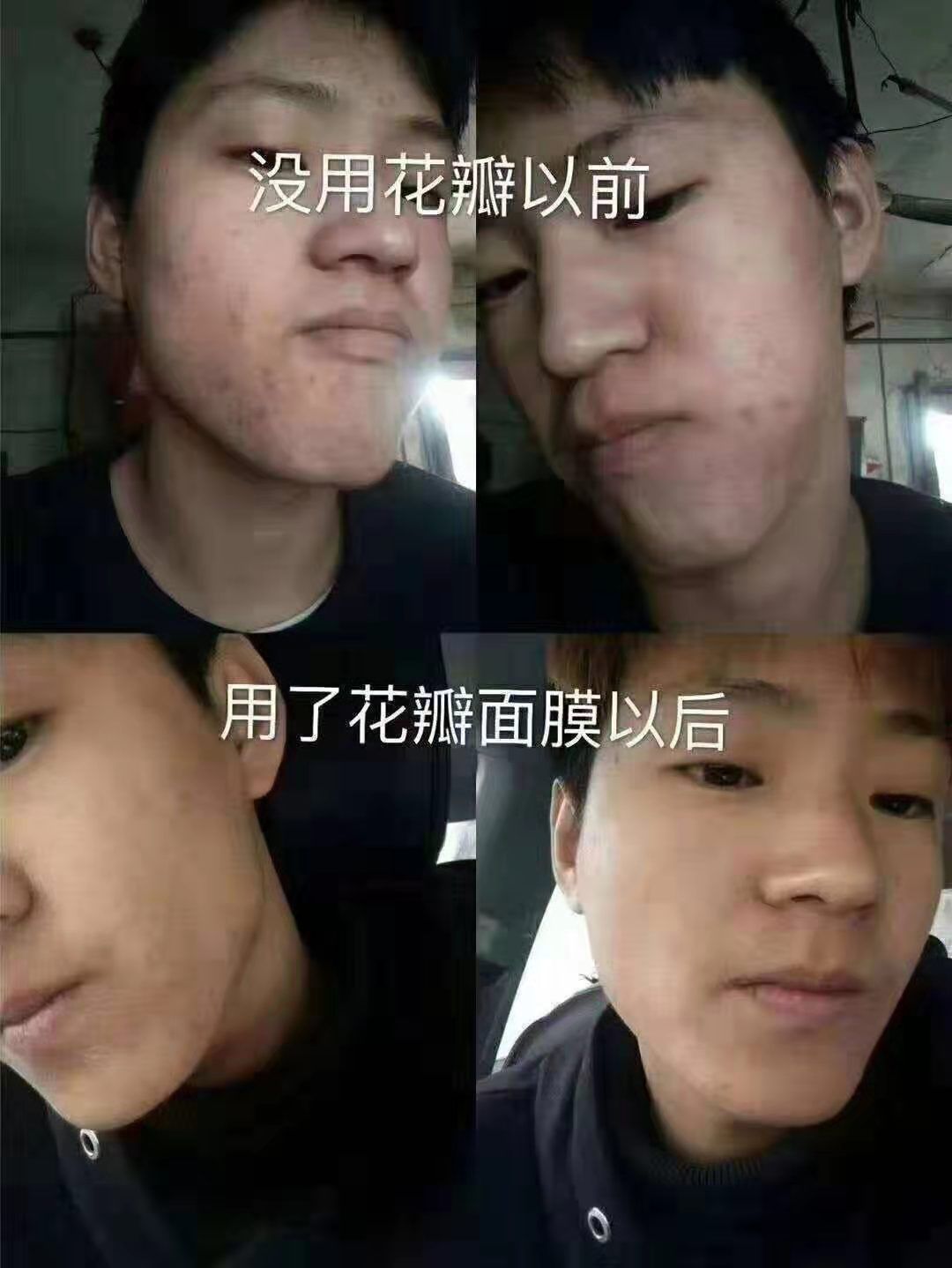 花瓣面膜 减肥产品