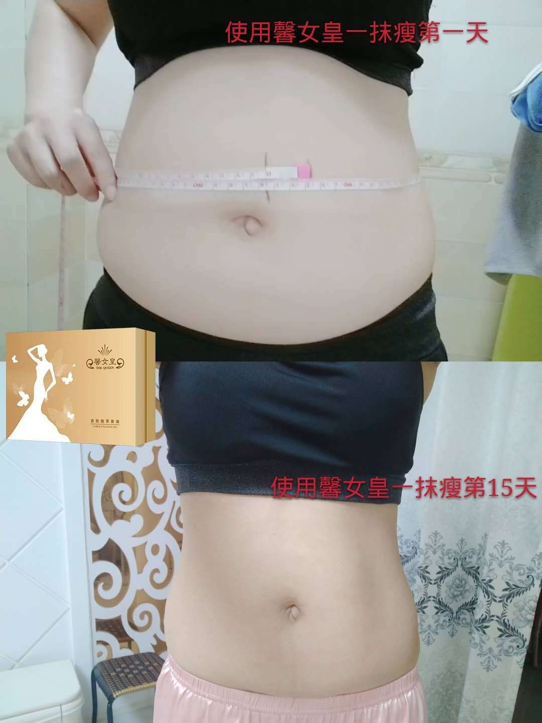 馨女皇一抹瘦