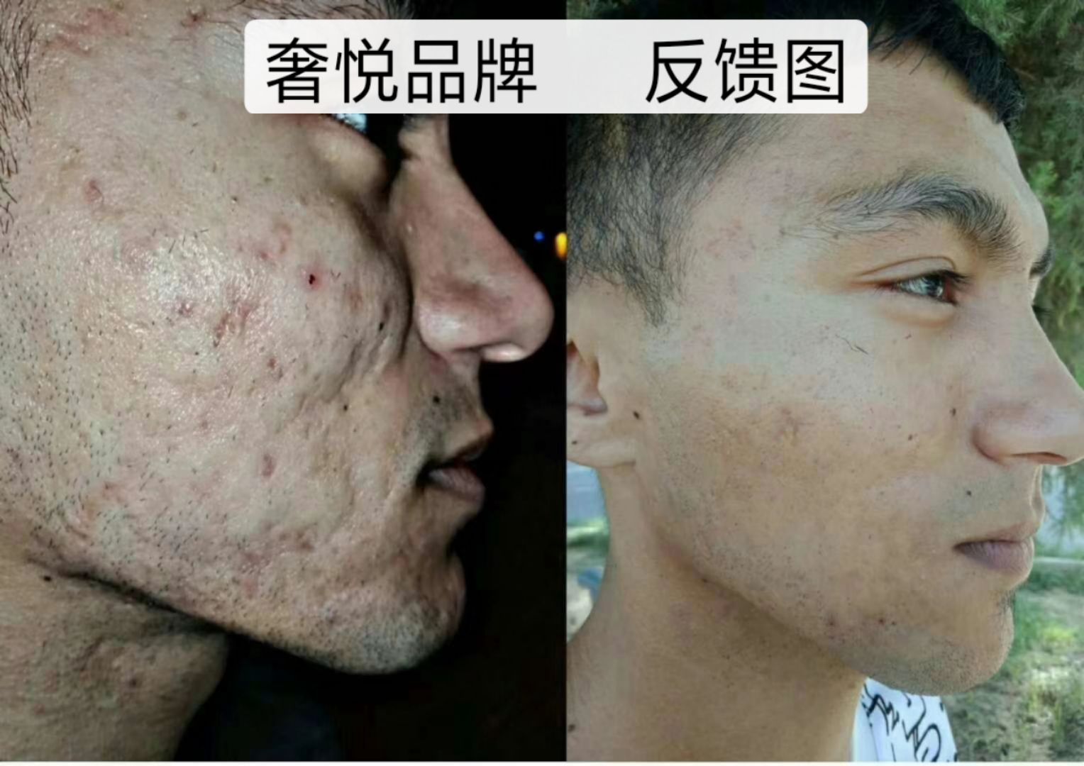 奢悦品牌护肤品 都是明星同款 招代理