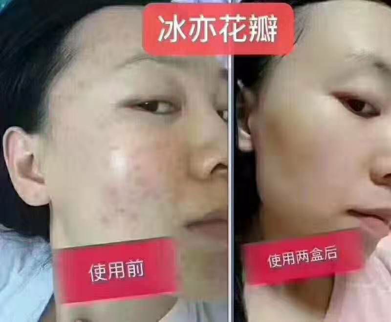 花瓣面膜主要功效：保湿，美白，祛痘，补水，安全的可以食用