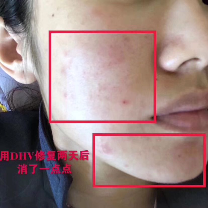DHV带你变美