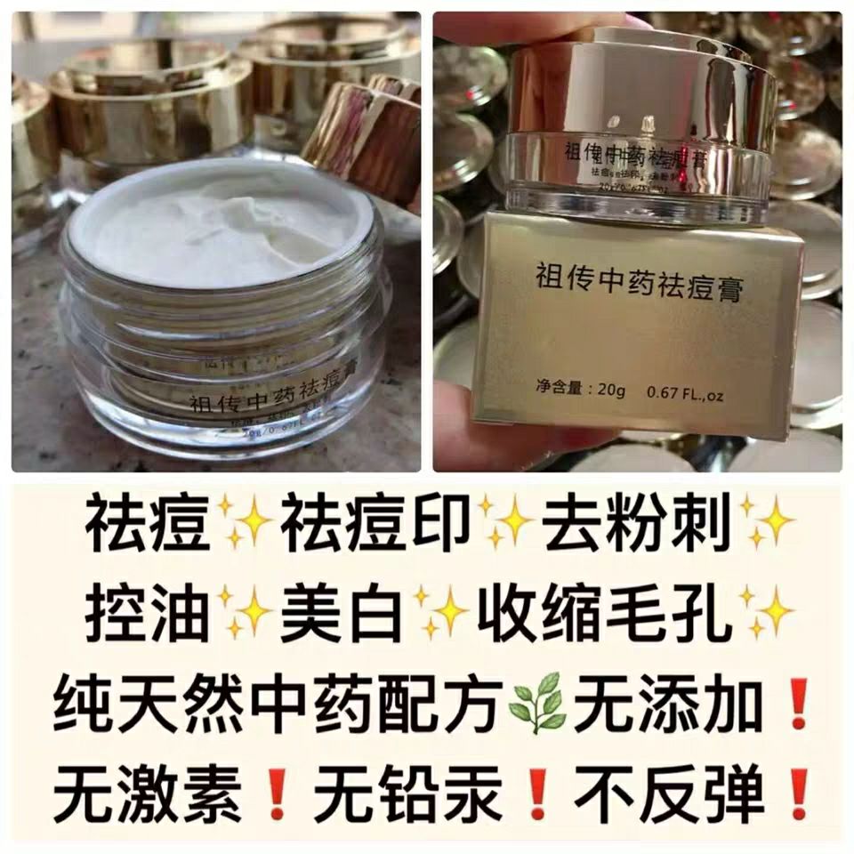 祖传中药祛痘膏