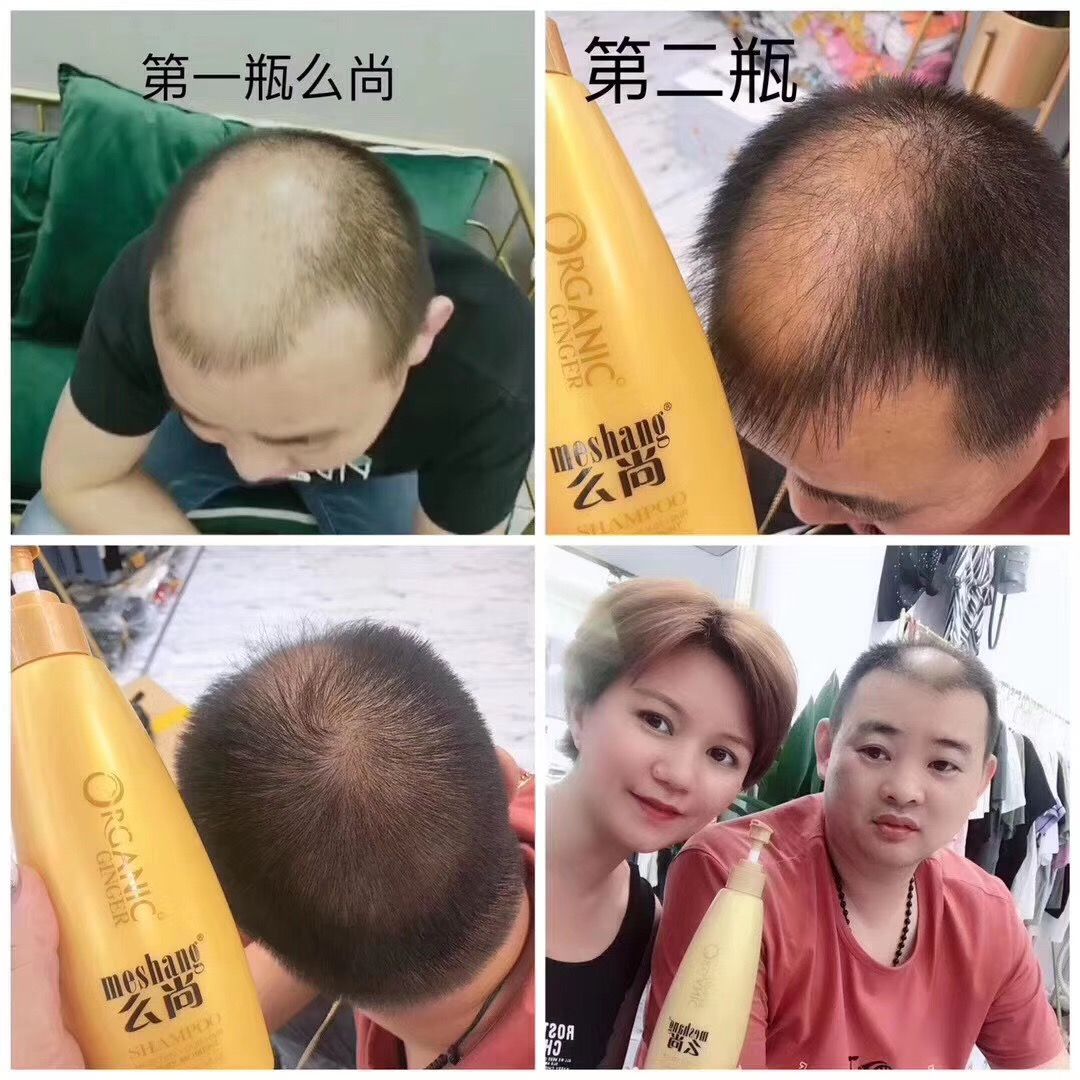么尚无硅油姜汁洗发水，关爱健康洗护