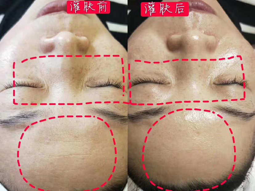 Dr.Mary 灌肤