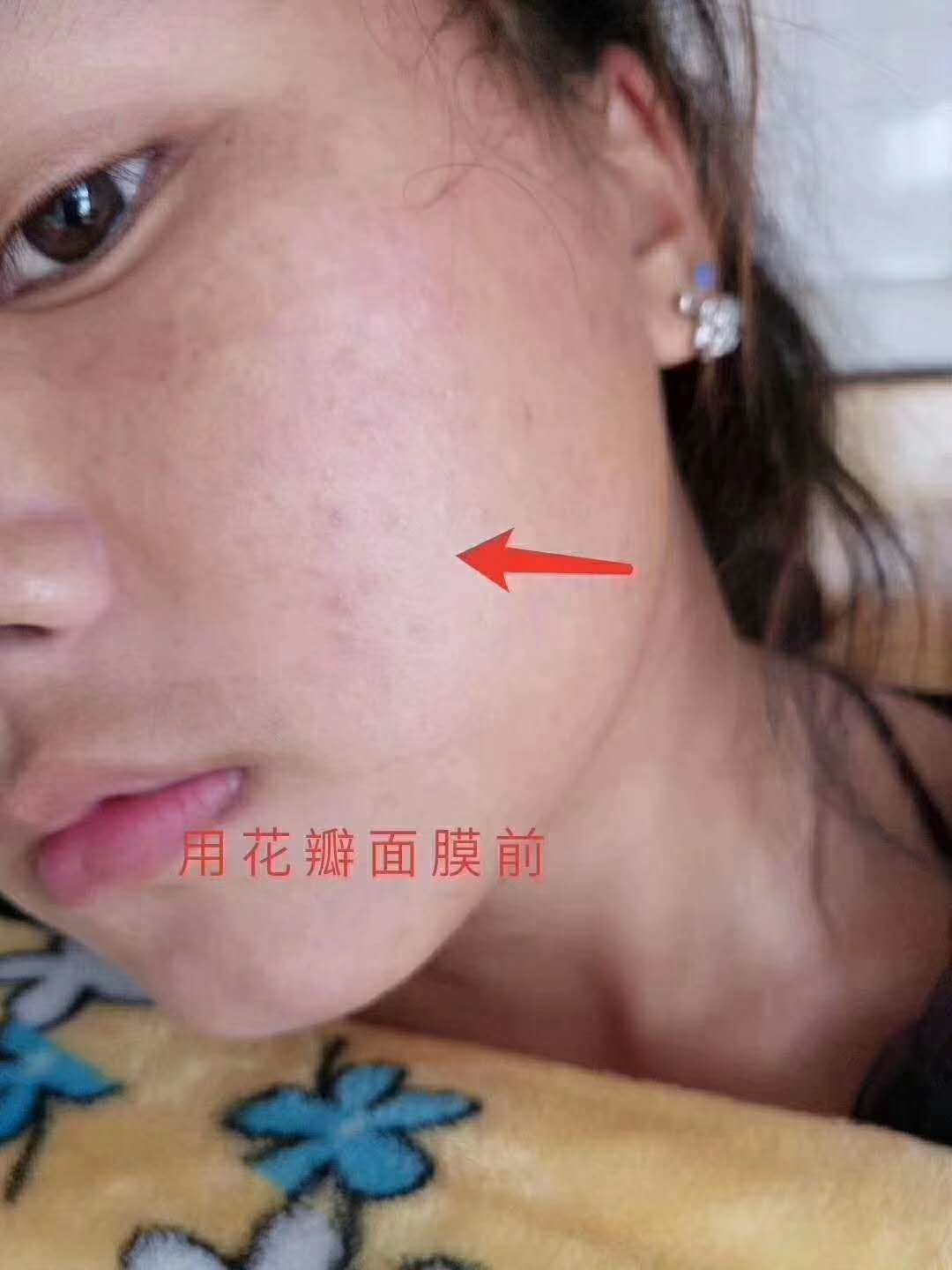 花瓣面膜 美白保湿祛痘祛红血丝