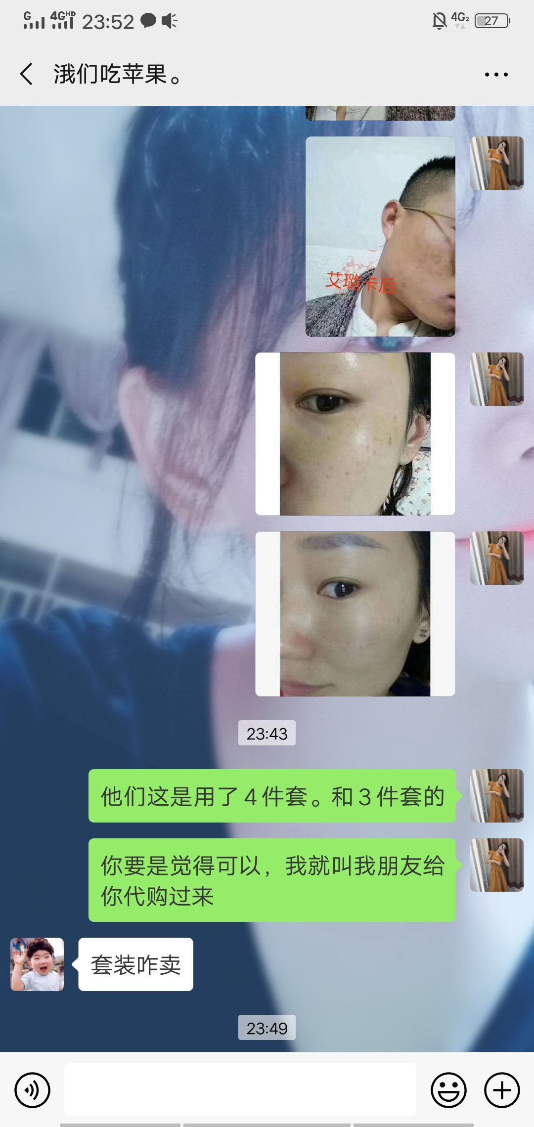 艾璐卡代理，赚钱，发家致富